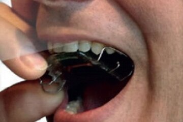 Beeld van: Rolstoelbesturing door de tong of vinger
