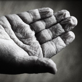 Zwart-wit foto van een gerimpelde handpalm.